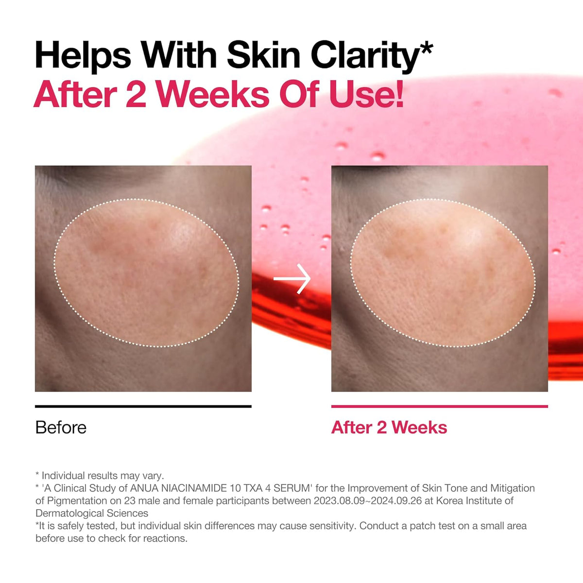 Anua - Niacinamide 10 TXA 4 Serum