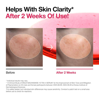 Anua - Niacinamide 10 TXA 4 Serum